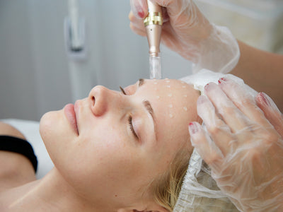 Microneedling  - 6 Behandlungen