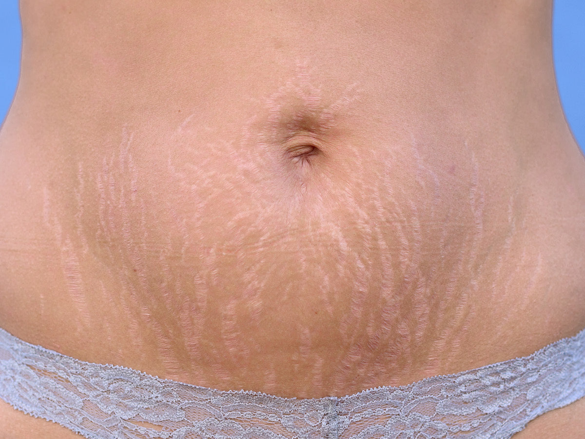 Image of Narbenbehandlung pro Stunde